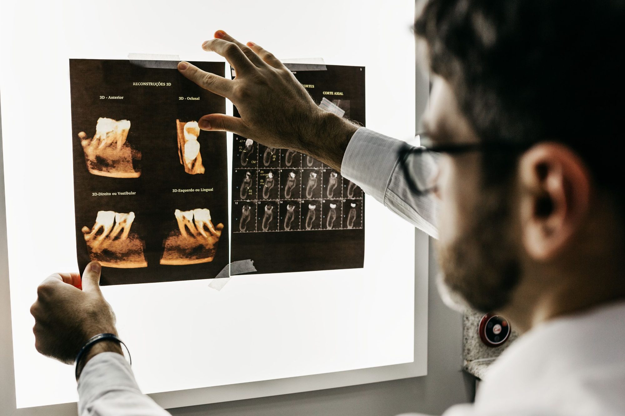 Medic care analizează pe negatoscop reconstrucții 3D și secțiuni de tomografie dentară