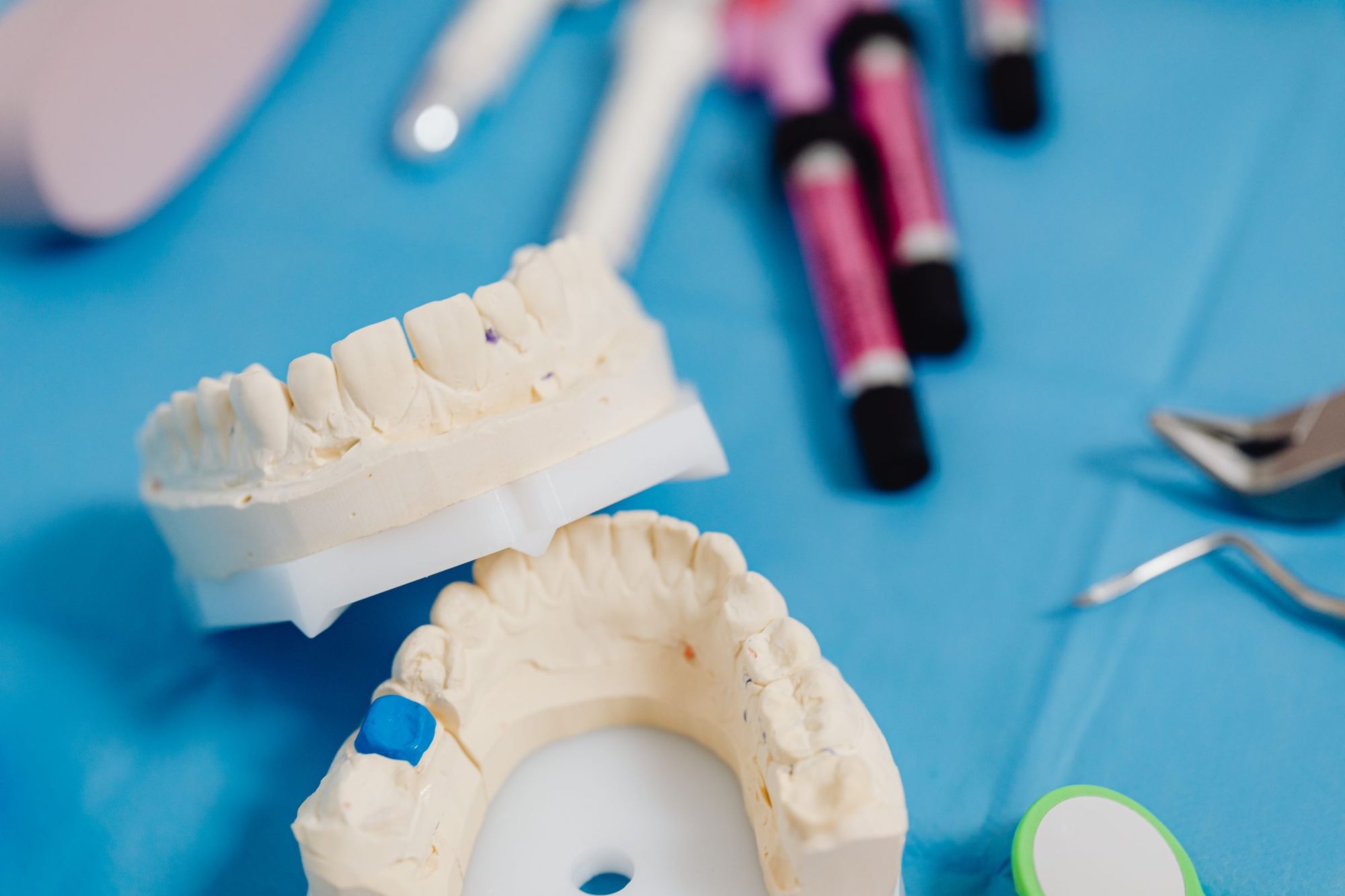 Modele din ghips ale arcadelor dentare, pe o masă de lucru cu instrumente stomatologice